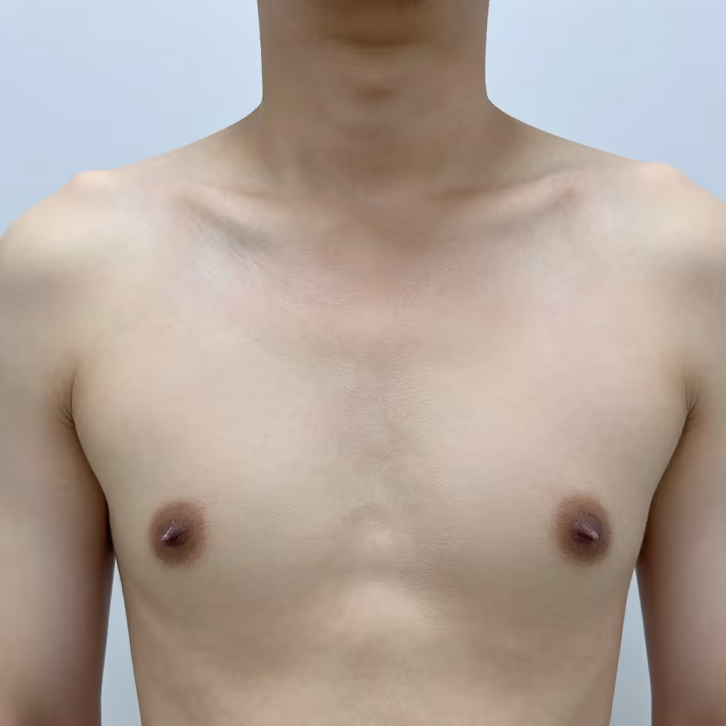 Visual example for Brustwarze